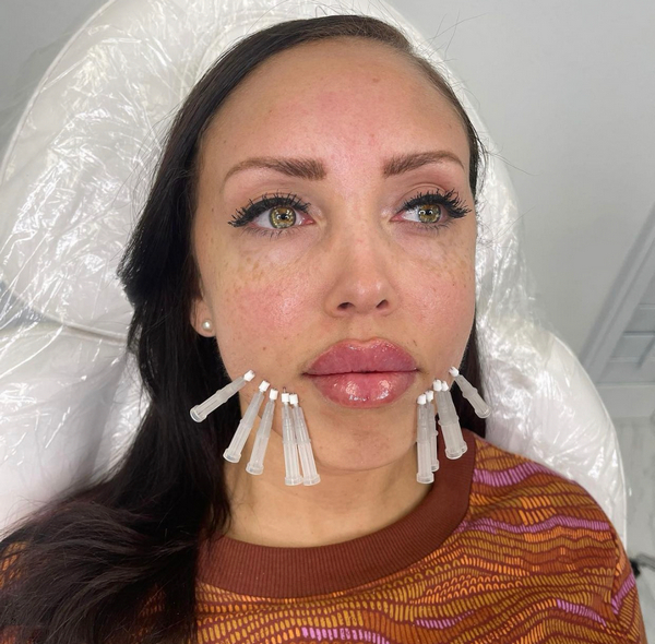 POD Thread 1c.jpg(Client3)