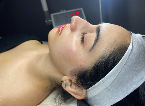 Skin Infusion Skin Infusion