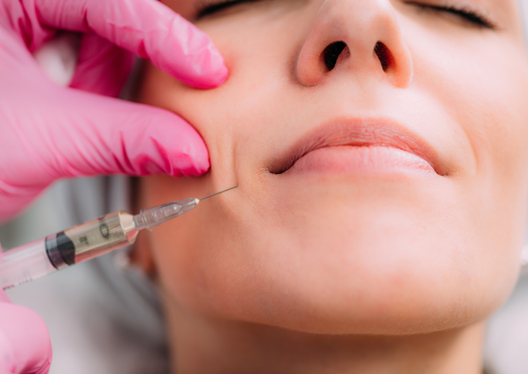 Smile LIne Filler Smile Line Filler